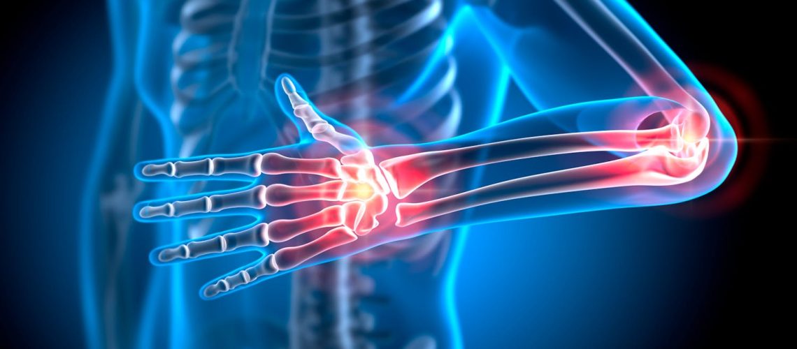 Le cubitus, un os plus important qu'on ne le pense